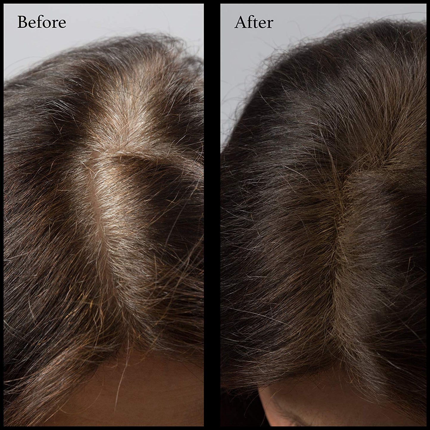 Hair Root Touch Up Powder - Medium Brown - 11 True-to-Nature Root Concealer Shades - Long-lasting, Fragrance Free, Paraben Free, Talc Free, Mineral Hairline Powder with Brush