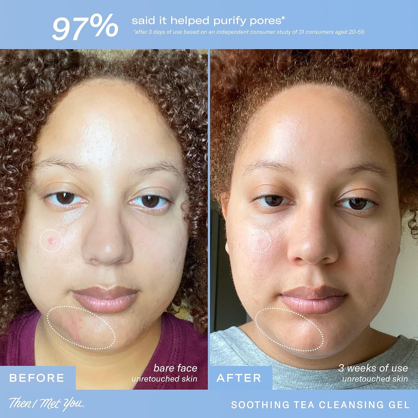 Then I Met You Soothing Tea Cleansing Gel, Hydrating Water-Based Face Cleanser with Fermented Rice Water & Green Tea, Vegan & Clean Skincare, 3.38 oz