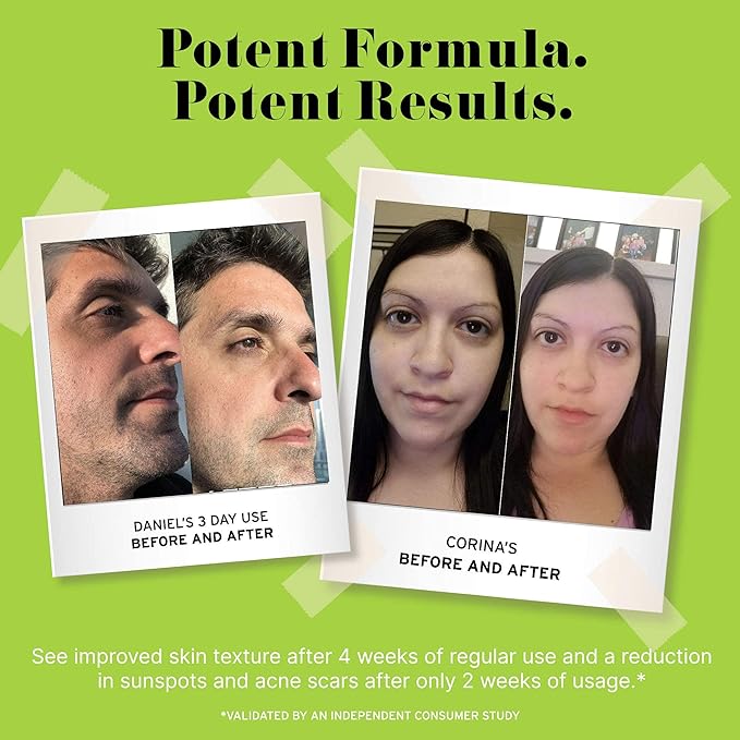 No B.S. Caffeine Eye Cream with Pure Hyaluronic Acid & Plant Based Squalane Oil, Under Eye Cream for Dark Circles & Puffiness, Skin Care for Women & Men, Travel Size, 0.5 FL Oz, and CoQ10 for Wrinkles