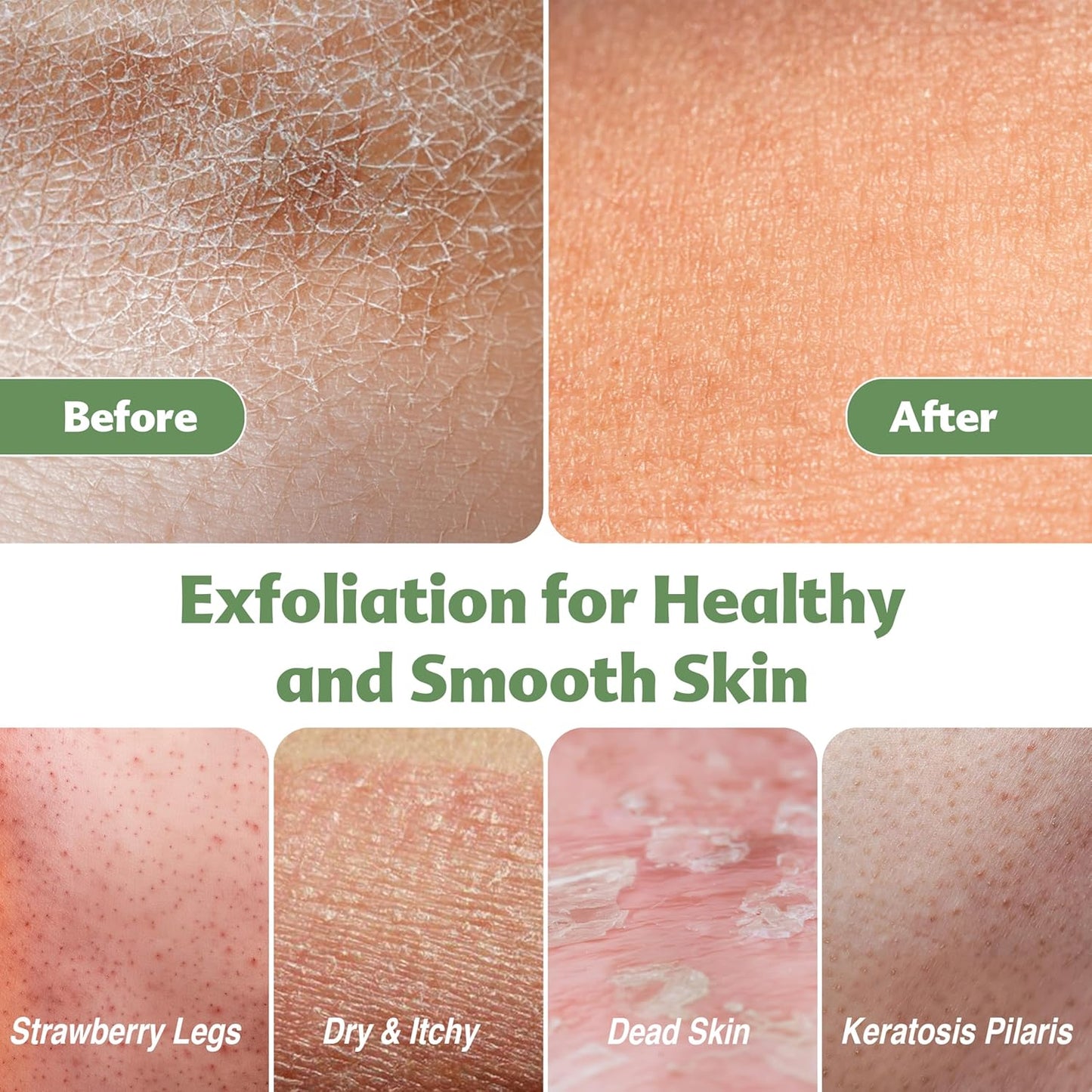 Set of Exfoliating Glove, Face Scrubber & Back Scrubber for Shower, 100% Vegan Viscose exfoliating body scrubber, Bath Hammam Kese & Spa Mitt