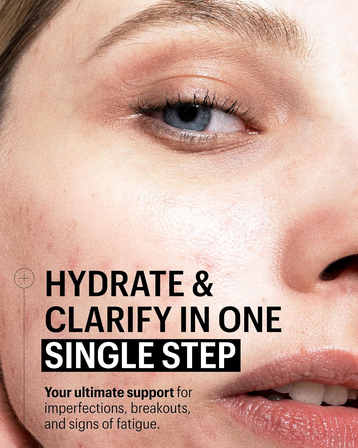 Allies of Skin Multi Nutrient & Dioic Renewing Cream: Moisturizer with Dioic Acid, 14 Antioxidants, Probiotics & Centella Asiatica. Targets Imperfections, Brightens & Protects Skin 1.7 oz / 50 ml